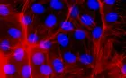 Confocal Fluorescence Microscopy of CRISPR-generated knockout cells.